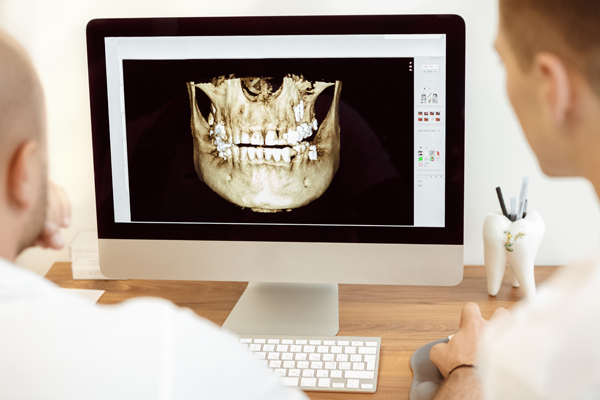 CBCT Image on Screen